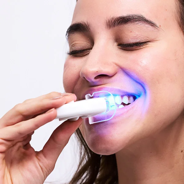 Home Teeth Whitening