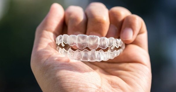 Vivera Retainers at Surrey Quays Dental Practice, Surrey Quays